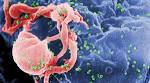Health | HIV AIDS | Fox News