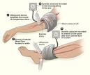 Ankle-Brachial Index (ABI) Test - Featured - tests-diagnosis ...