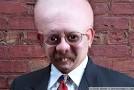 Weird Bald Guy