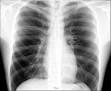 Chest - Wikipedia, the free encyclopedia