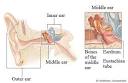 Middle Ear: Healthwise Medical Information on e Medicine Health