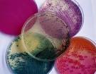 cell <b>cultures</b> and