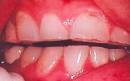 Teeth and Mouth Photo Gallery