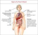 Signs of a heart attack | womenshealth.