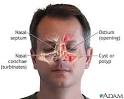 Basic Nose Anatomy | Deviated Nasal Septum