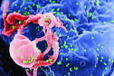 How to treat Hepatitis C | Daily Health News