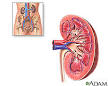 discharge · <b>Wilms tumor</b>
