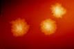 Clostridium difficile - Wikipedia, the free encyclopedia