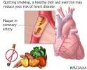 Coronary artery disease