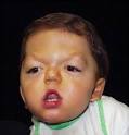 parrot-beak nose,
