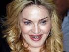 6C8709996-130822-madonna-teeth.