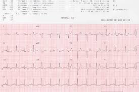 EKG 1, [EKG 1]