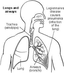 of Legionnaires disease?