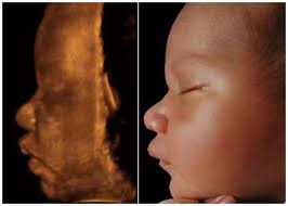 3D Images Of Babies