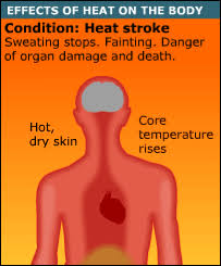 Heat stroke is a form of