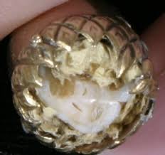 pictures tooth crown