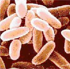 Anthrax outbreak in Zimbabwe