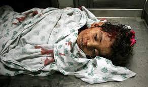 من مذابح اسرائيل Gaza-killed-child