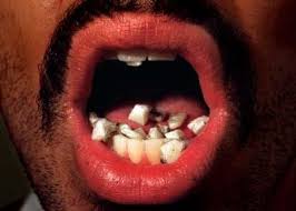 external image crack.jpg