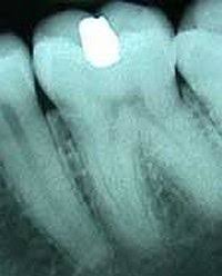 dientes celulas madre Dientes a partir de Células madre