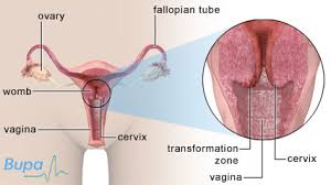 Types of cervical cancer