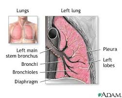 Defining Pneumonia by Location