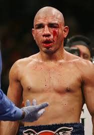 See gallery Miguel Cotto