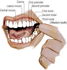 wisdom teeth