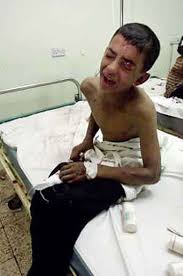  طفل عراقي يحرق نفسه لإخفاقه في الامتحانات في زاخو   Tifl