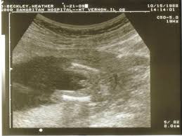 ultrasound at 16 weeks