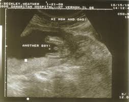 ultrasound at 16 weeks