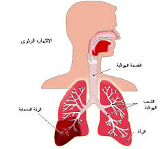 سبع غرائب بأجسامنا Pneumonia2