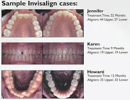 sample cases