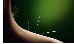 Acupunctura