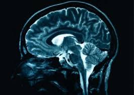 The human mind: 3- Making friends