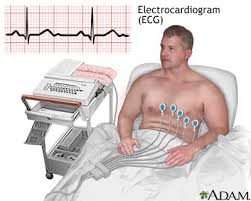 L'électrocardiogramme pathologique 1135