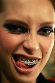 platinum grillz
