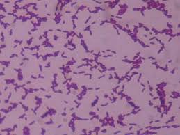 Gram coloration of Listeria