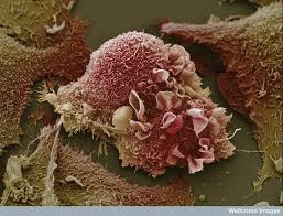 اكتشاف الخلية التي يحتمل أن تكون مصدر سرطان البروستات!!  Clip_image010