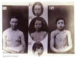 Duchenne published in the