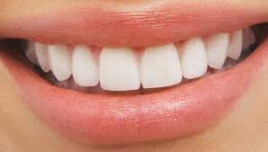 علاج اصفرار الاسنان * Dents