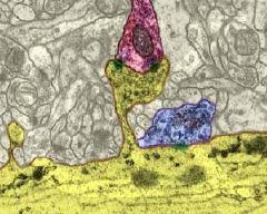 En la micrografía, la dendrita está teñida de amarillo y una espina dendrítica recibe una conexión sináptica 