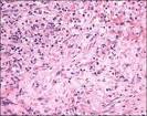 and <b>plasma cells</b>;