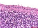 this <b>lymphoid tissue</b> are