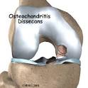 <b>Osteochondritis Dissecans</b> of