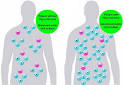 Nana Lana: <b>Water Intoxication</b> Causes Blindness