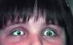 M10 Right eye <b>microphthalmos</b>