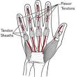 <b>Tendons</b> are tissues that