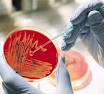 AiCuris - <b>Bacteriology</b>