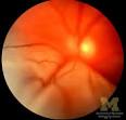 The Eyes Have It: Principal Ophthalmic Conditions